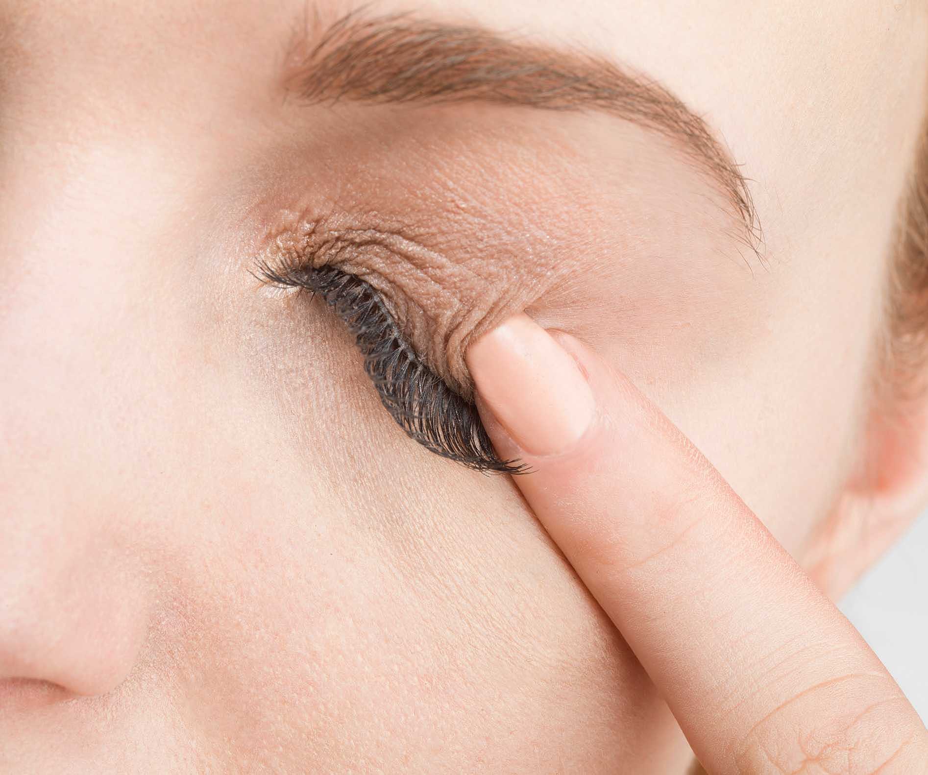 Afinal, coçar os olhos faz mal? Entenda! - Olhar Certo Clínicas ...